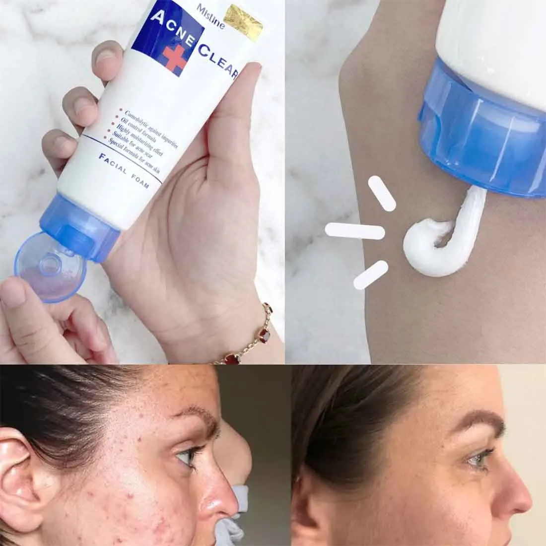 Mistine Acne Clear Face wash 85g